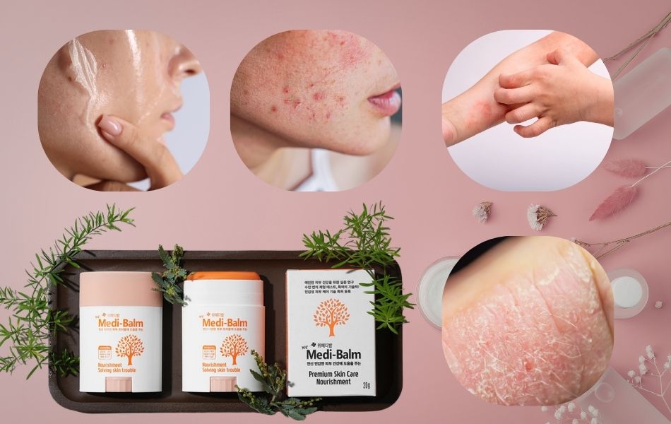 weMedi Balm phù hợp cho mọi loại da kể cả làn da nhạy cảm